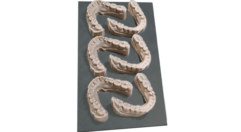 Dental Model Resin - Image 3