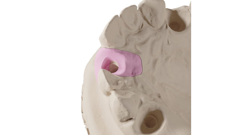 Flexible Dental Resin Pink - Image 3