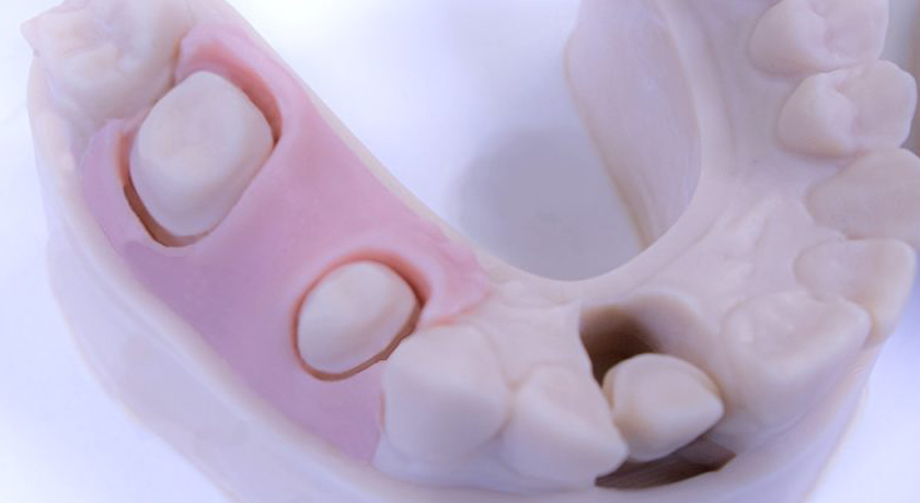 Flexible Dental Resin Pink - Image 2