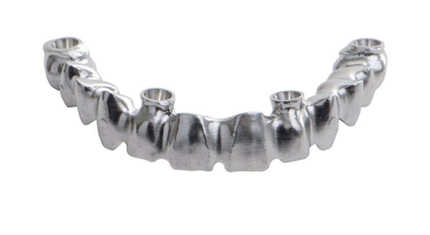 Milled Cobalt-Chrome Bridge & Bar - Image 3