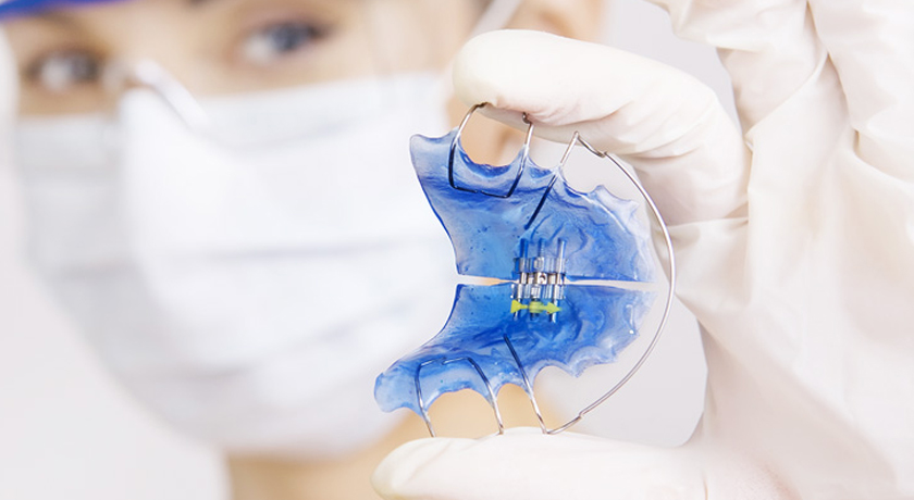 Orthodontic Appliances