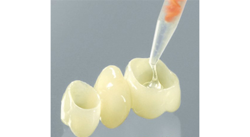 Temporary Resin Cement - Image 2
