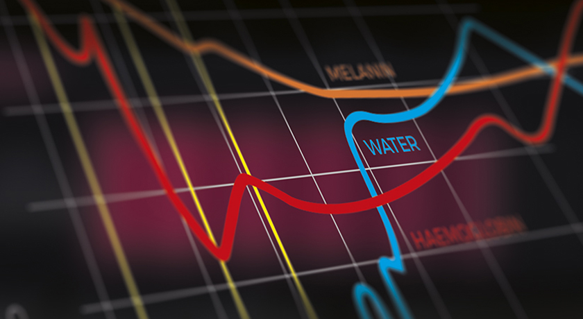 Diode Laser Wiser 3 - Image 3