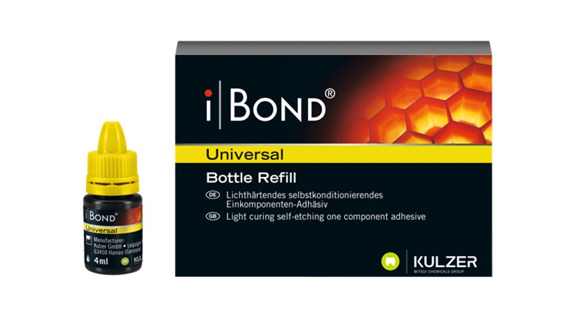 Kulzer iBond