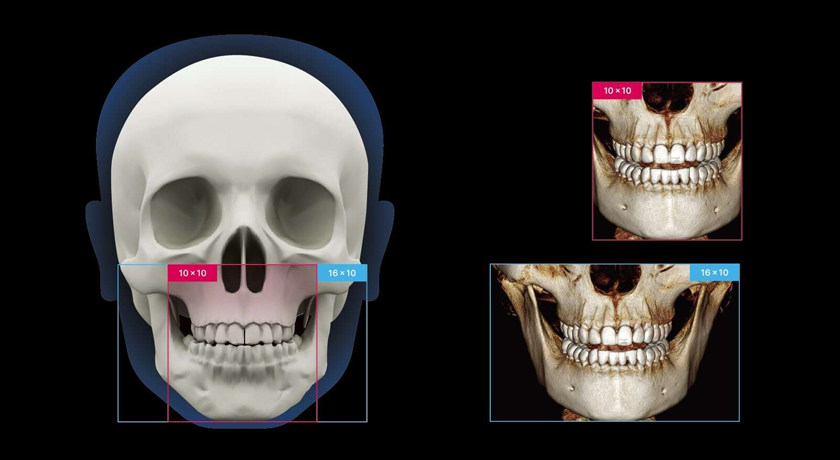 Ray Quantum - Image 5