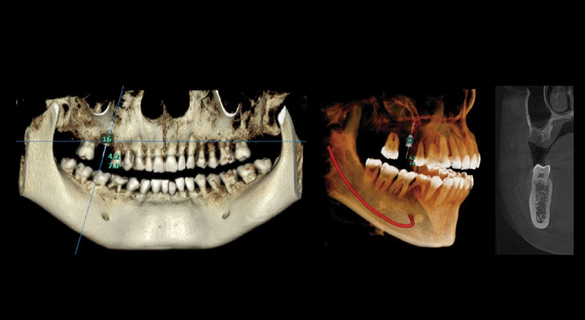 Ray Quantum - Image 4