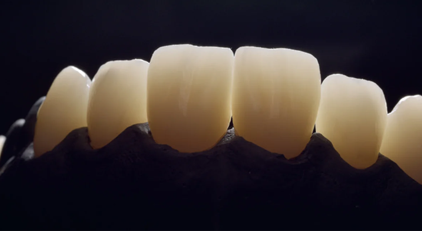 Sagemax NexxZr®+ Multi aesthetic - Image 2