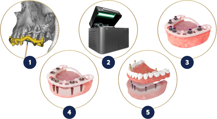MIS MGUIDE® - Image 3